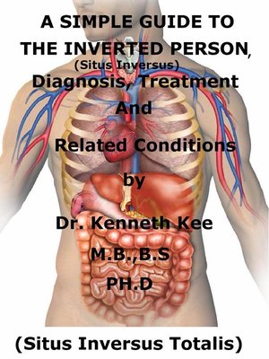 cover image of A Simple Guide to the Inverted Person, (Situs Inversus) Diagnosis, Treatment and Related Conditions